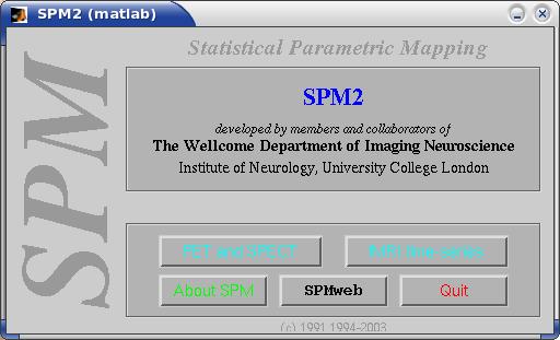 Start SPM IntroLab < SPMLabs < Dynevor TWiki Open Matlab. Check that spm is on the Matlab Path by typing spm If an error occurs then you must add the spm path to the Matlab.