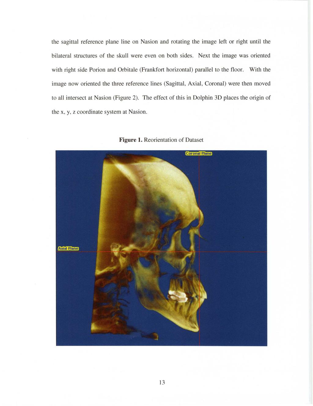 the sagittal reference plane line on Nasion and rotating the image left or right until the bilateral structures of the skull were even on both sides.