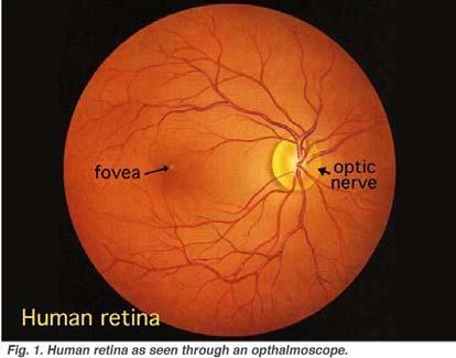 Optic Nerve 2 קרנית - Cornea