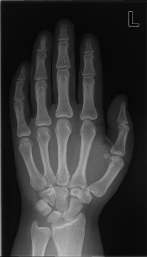 Figure 1: Intra-class variability within the class annotated as x-ray, plain radiography, coronal, upper extremity (arm), hand,