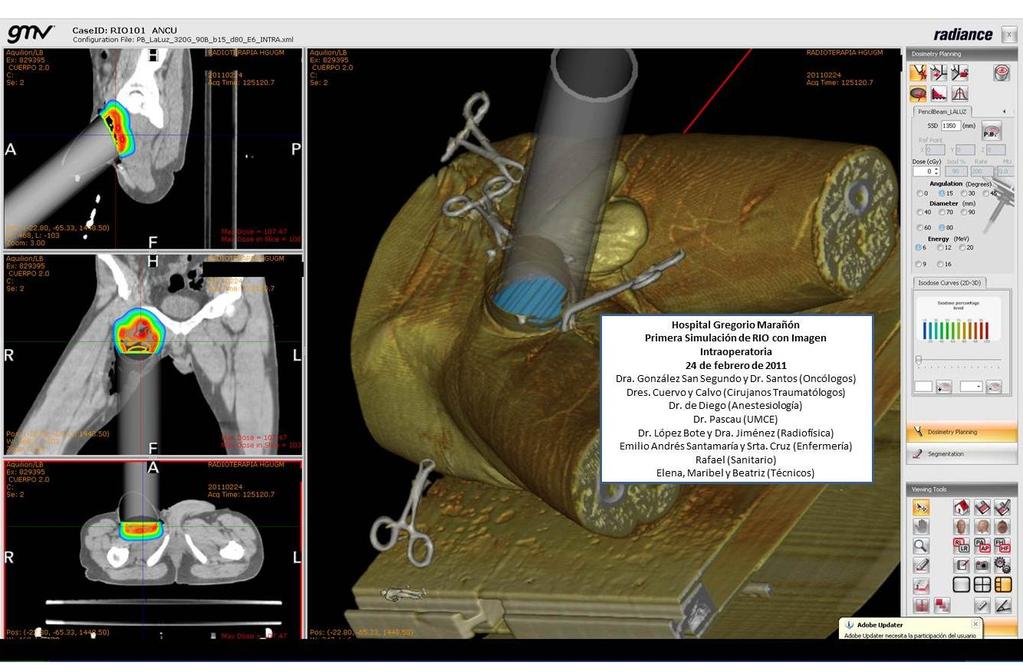 INTRAOP IMAGING FOR INTRAPLANNING