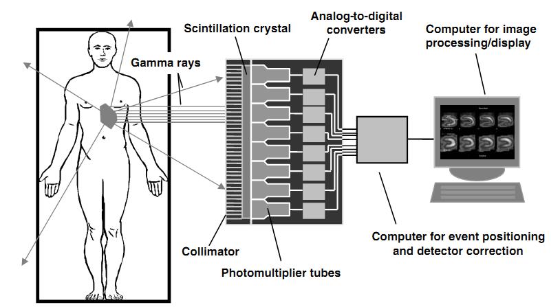 Single Photon Emission Tomography (SPECT)