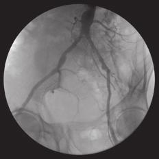 5 frames per second (up to 30 fps with the Primax Turbo option) / Angio (Option) - Extensive angiography package, including