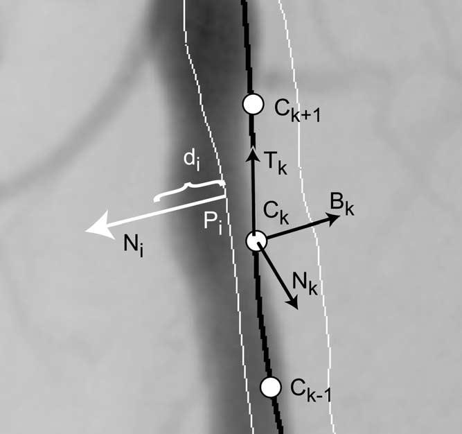 Academic Radiology, Vol 12, No 1, January 2005 3D ELASTIC REGISTRATION OF VESSEL STRUCTURES face point towards the focal point (in this case the x-ray source position) is tangent to the surface.