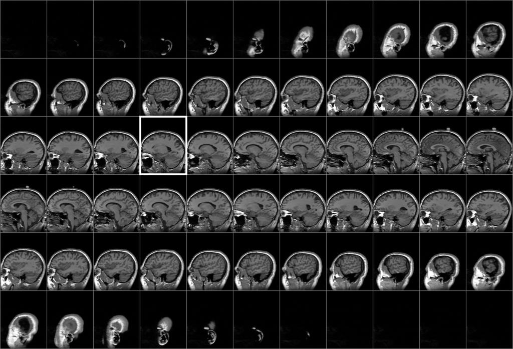 Figure 1-1: Input data example. The top picture shows a set of slices from a sagittal MRI scan of a head arranged in the left-to-right order; every third slice is shown.