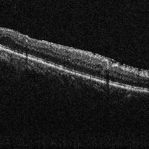 (a) (b) Figure 2. (a) Exemplar OCT scan slice featuring curved retinal layers and (b) resulting flattened slice from (a) with the RPE layer boundaries highlighted in red.