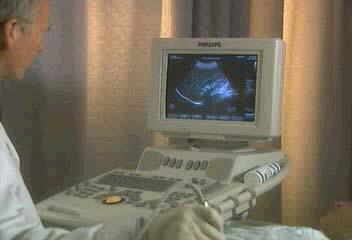 Ultrasound procedure environment