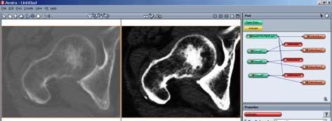 Sigmoid Filter Sigmoid-Filter applied on a grayscale image (upper left): (upper right: a=80; lower left: a=0; lower right: a=00).