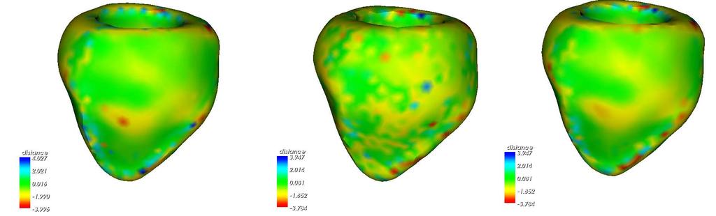 Construction of Left Ventricle 3D Shape Atlas from Cardiac MRI 93 Fig. 4. Visual validation of geometry processing methods. The errors of each vertex is plotted using different color.