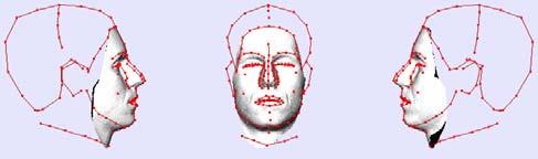model from [6] in the eye, nose and mouth regions in order to make it more suitable for our laser-scanned face input.