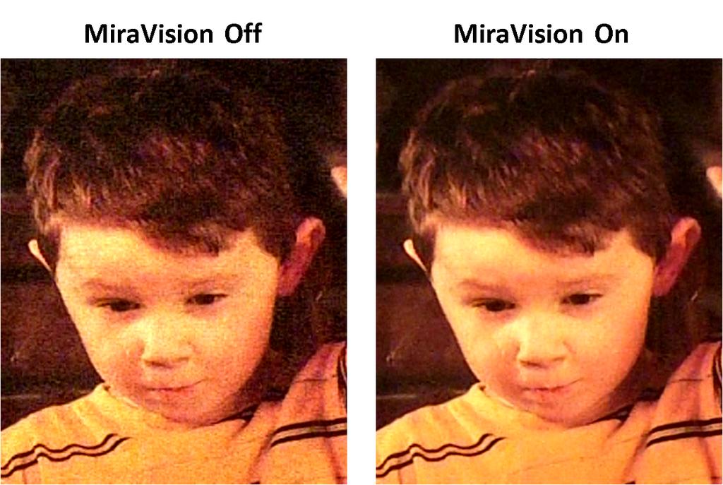 MiraVision Figure 3. MiraVision Random Noise Reduction Figure 4.