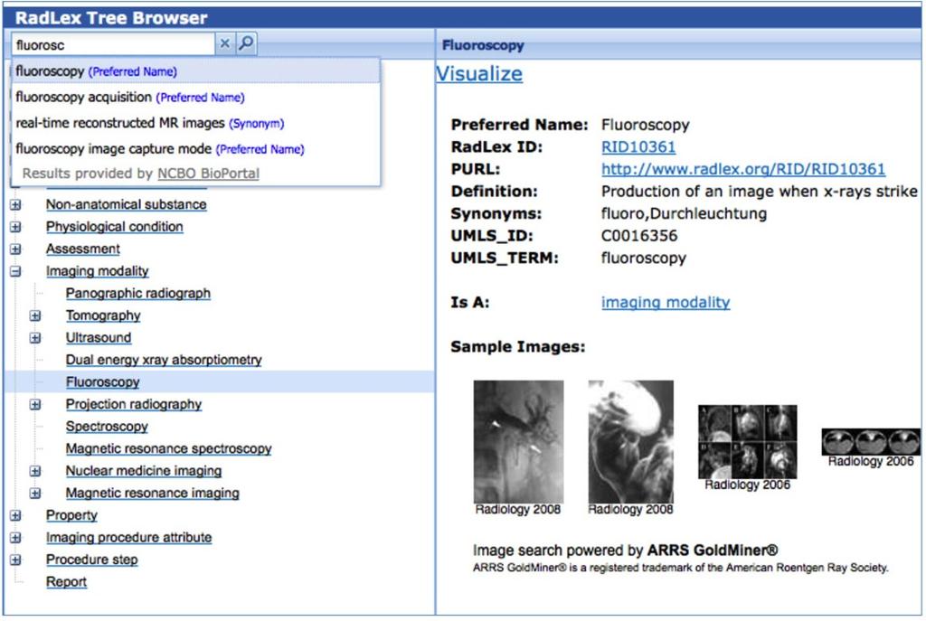 Page 5 of 10 Figure 3 RadLex Term Browser RadLex term details and hierarchy are displayed using the NCBO Web services. The browser is customized to display additional term details, e.g. Sample Images, and the user interface is designed to meet the requirements of the Radiological Society of North America.
