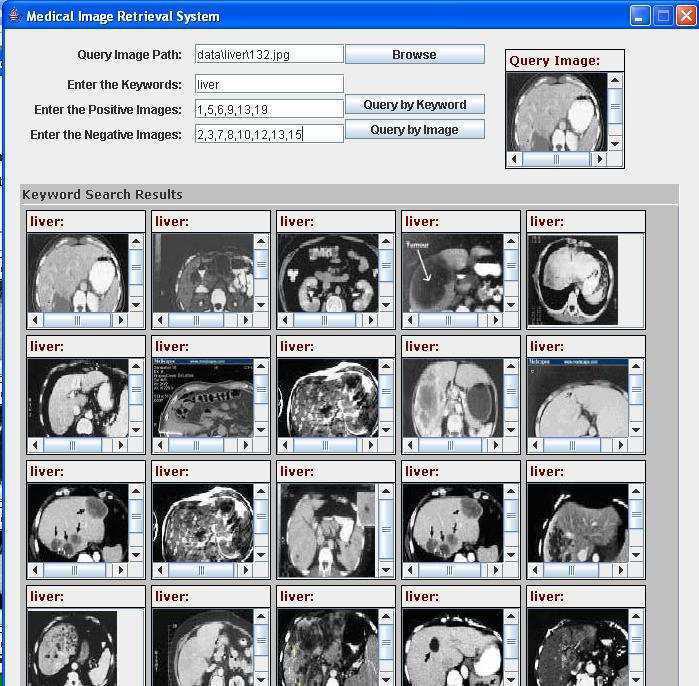 205 Figure 6.8 MedIR System Positive and Negative Feedback Images When the user selects the query by image button, the new search results will be presented to the user.