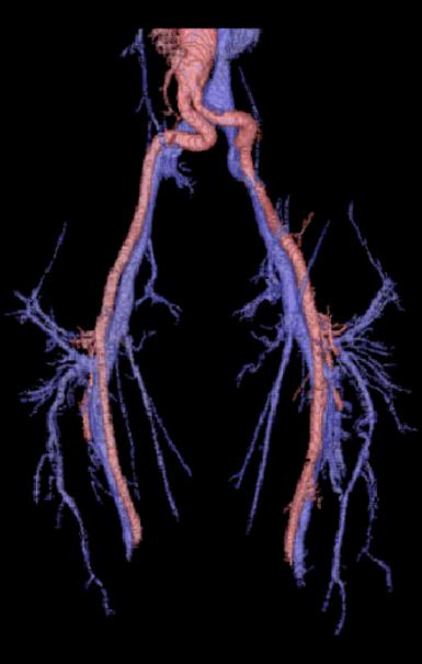 togetherness and path connectivity CE-MRA Image data Segmented vasculature Separated arteries/veins Separation of arteries and