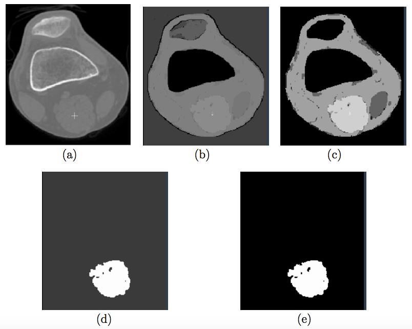 Illustration of equivalent affinities. (a) A 2D scene a CT slice of a human knee. (b), (c) Connectivity scenes corresponding to affinities ψ σ with σ = 1 and σ = 10.