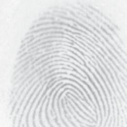 B. Global Analysis The magnitude spectrum of a fingerprint image typically contains a circular structure around the origin.