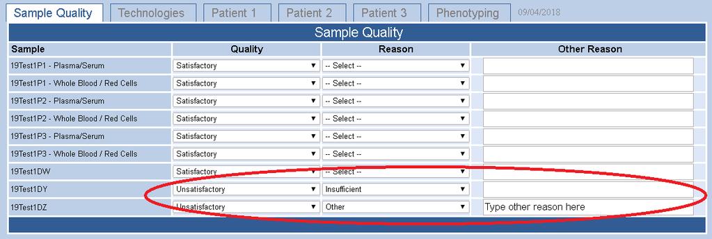 Data Entry Pre-Transfusion Testing - Web return of results Sample Quality The default response for sample quality is Satisfactory.