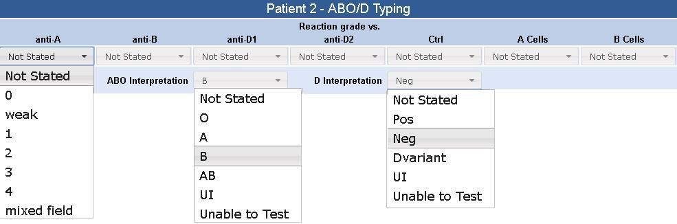 ABO/D typing ABO and D reaction grades and interpretations can be selected using drop-down, as shown in figure 7. UI should be selected when a result would not be issued on a clinical sample.
