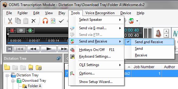 Configure Automatic Receiving of Files ODMS Release 6 Transcription Module can be configured to automatically receive dictation files via your specified receive method.