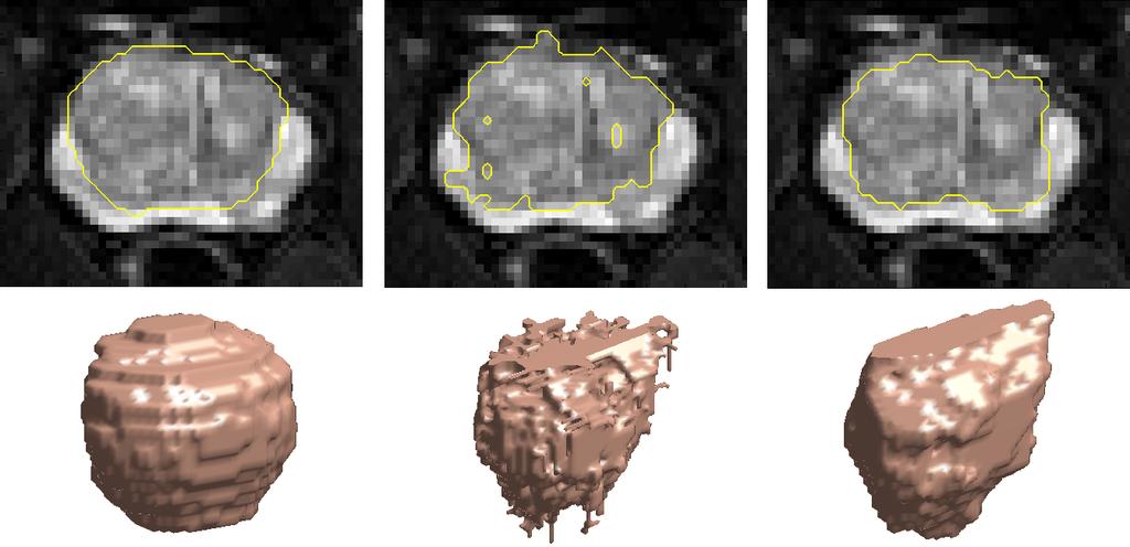 2 MOSCHIDIS, GRAHAM: GRAPH-CUTS WITH FEATURE DETECTORS Figure 1: An axial slice of a T2 fat suppressed prostate MR image, with a line delineating the Central Gland (top) and a 3-D segmentation of the