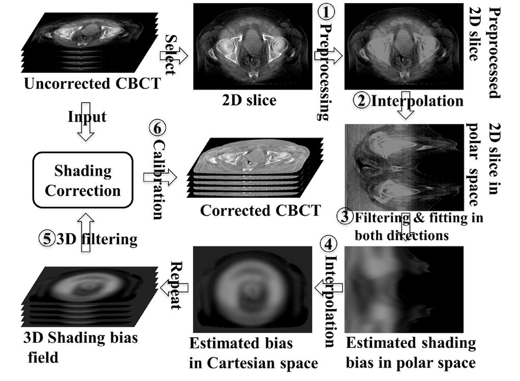68 Fan et al.: Image-domain shading correction for CBCT 68 bias field. The pixels of these structures were first identified based on fixed image-value thresholds and image processing techniques (i.e., image erosion and dilation) and then filled with constant image values of water.