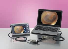 with Universal Monitor 8403 ZX or the new USB video otoscope in conjunction with your laptop/desktop PC Shutter/video release and manual focus