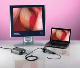 video otoscope can be connected to the C-HUB II Plug & Play USB output for connection to a PC, laptop or Mac S-Video/HDMI output for connection