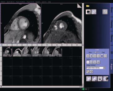 Argus Viewer Viewing software for cardiac MR studies and large data sets Efficient cine review of cardiac and other dynamic imaging data sets Dynamic imaging data sets Single movie as well as 2, 4,