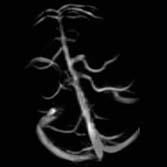Angio Suite The Angio Suite is also a part of the Multi Channel Application Suite. Excellent MR Angiography can be performed to visualize arteries and veins without contrast agent.
