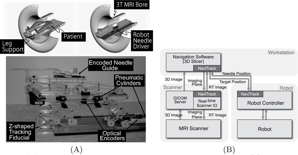 704 J. Tokuda et al. Fig. 1. (A) A robot for transperineal prostate biopsy and treatment [9]. Pneumatic actuators and optical encoders allow operating the robot inside a closed-bore 3T MRI scanner.