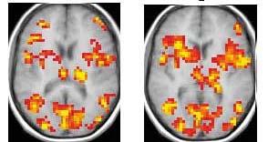 functional Magnetic Resonance Imaging Measures neural activity indirectly based on the rate of metabolism - Blood