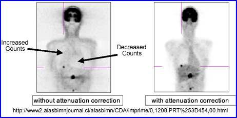 Data Correction Aim: obtain clinically useful images and accurate quantitative information from PET studies.