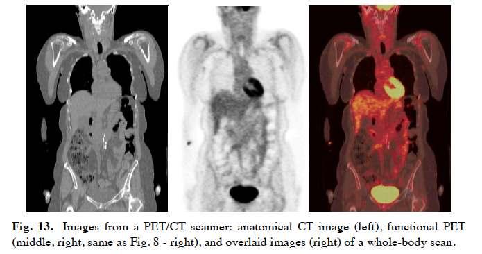 PET/CT acquisition CT image PET image
