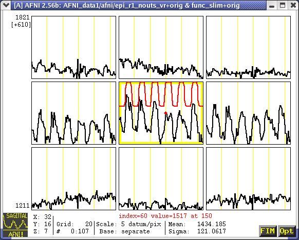 AFNI Time Series Graph Viewer Data (black) and