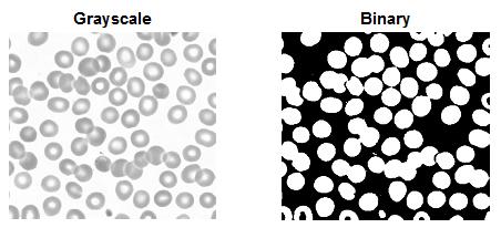 6 shows the gray scale and binary images and Fig.7 shows the watershed segmentation effect with different DTs for the binary image of a blood smear sample-1.