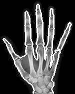 Numerical Experiments - MBS Hand: Original (left),
