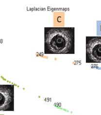 4 Method Isomap [10], local linear embedding [11], and Laplacian eigenmaps [12] are three different techniques