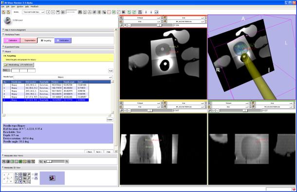 9 Multiple views management Displaying information in the control room and in the operating room is implemented by creating a viewer window that is independent from the Slicer main window and so can
