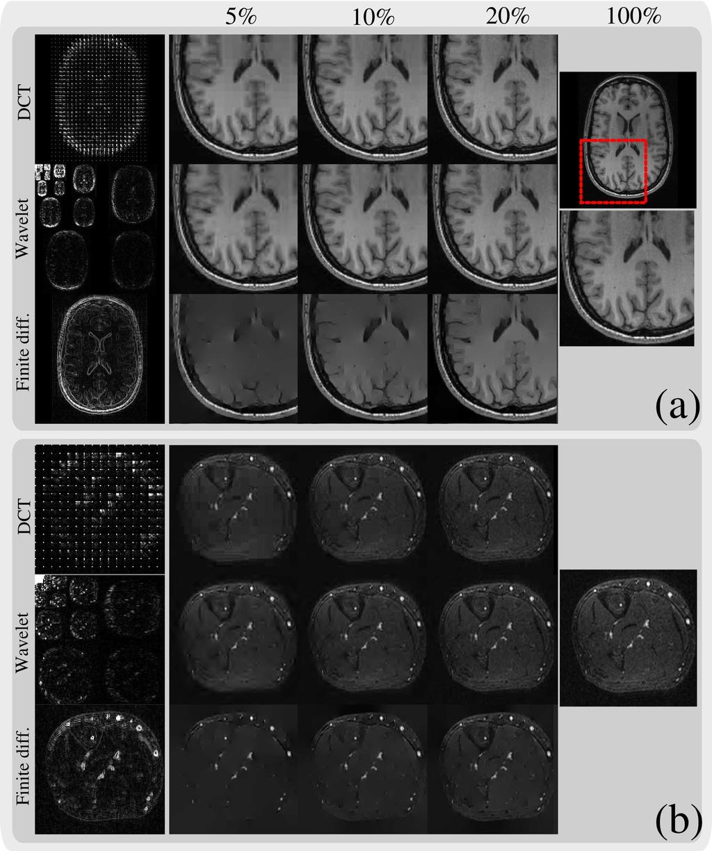 Figure 3: Transform-domain sparsity of images. (a) axial T 1 weighted brain image; (b) axial 3D contrast enhanced angiogram of the peripheral leg.