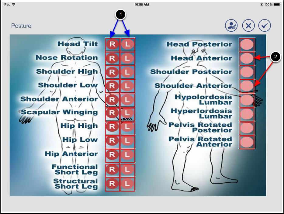 SpineTech SOAP Help Manual Posture The posture screen is used to note abnormalities with a patients posture.