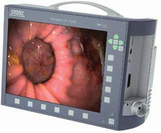 Mobile Endoscopic Imaging System Five devices, one compact unit This high-performance, all-in-one unit integrates every component necessary for endoscopic imaging: camera, light source, monitor,