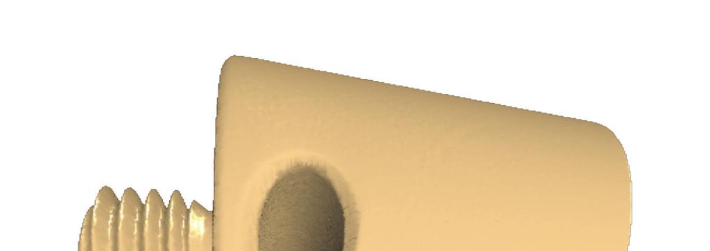 Figure 6: M5 screw thread density field after the thresholding filter application. 1. Process each planar section (bucket) as described by Kosarevsky and Latypov in [15].