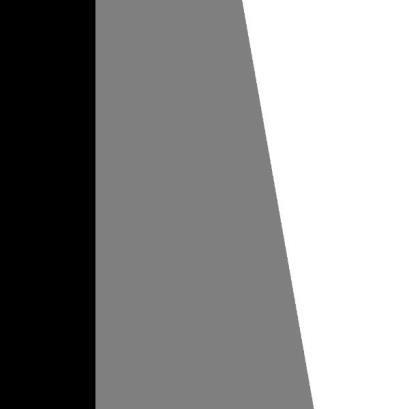 bipolar layer When describing the visual effect of above images, the cone