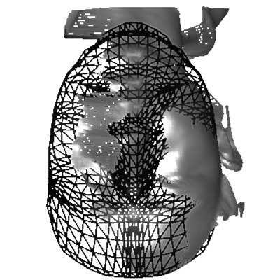 4 Registration To fit the AFM to each facial scan, they must both be defined in the same coordinate system (Fig. 7). To this end, we register the facial scans with the AFM using a two stage approach.
