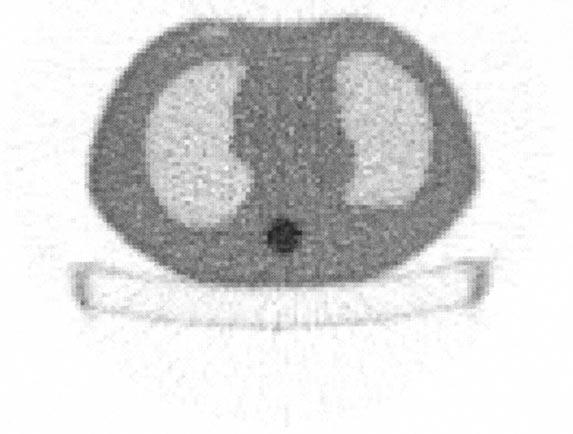 ERDOǦAN AND FESSLER: MONOTONIC ALGORITHMS FOR TRANSMISSION TOMOGRAPHY 809 (a) Fig. 5.