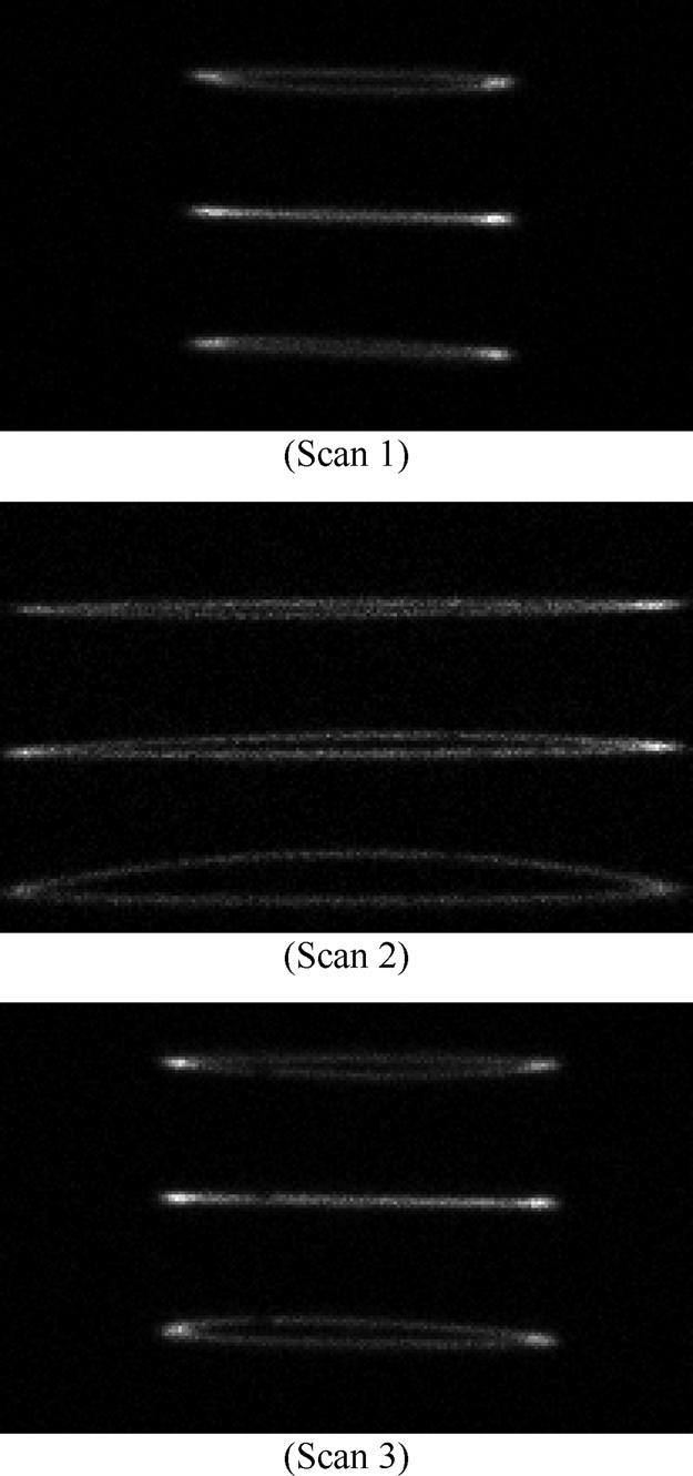 PIATT AND ZENG: A BACKPROJECTION-BASED PARAMETER ESTIMATION TECHNIQUE FOR SKEW-SLIT COLLIMATION 691 TABLE VI ESTIMATED PARAMETERS FROM THREE EXPERIMENTAL POINT SOURCE SCANS. (1 unit = 2:33 mm) Fig. 6. The separate projection data sets of a single point source viewed from 60 different angles.