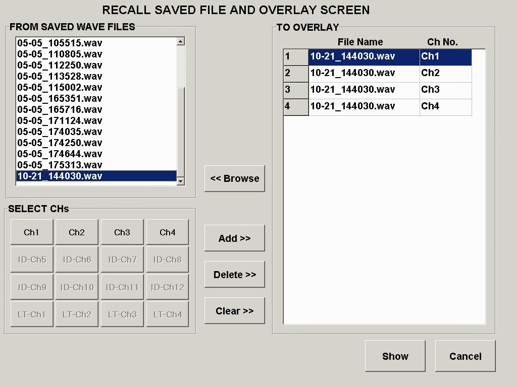 OVERLAYS SCREEN The Overlays Screen (viewed by pressing the Overlays button in the wave screen) allows the operator to manage various stored waves, and select up to 20 wave overlays to be displayed