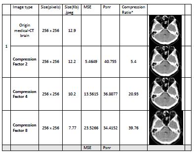 Advances in Image and Video Processing Volume 2, Issue 6, December 2014 Table-2 results using DCT method for CT and MRI