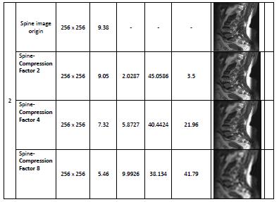 both CT and MRI images is better than DCT compression method.