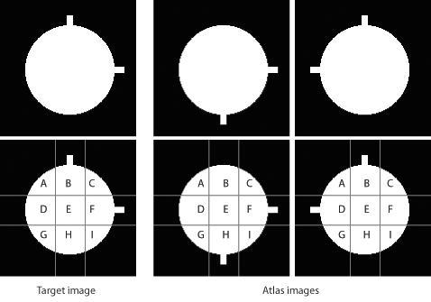 edge of the object to be segmented. In that case, additional registrations can be beneficial, especially if scans that are locally similar to the target image are used.
